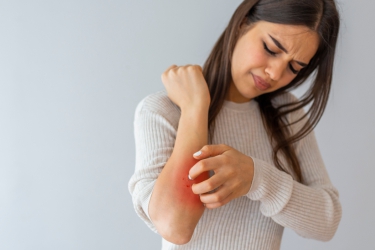 Treatment of Skin Allergy, Fungal Infection, Herpes, Dr Poonam Raut, Best Skin Speciaist in Purnia, Skyn & Laser Clinic, Treatment of Herpes in Purnia