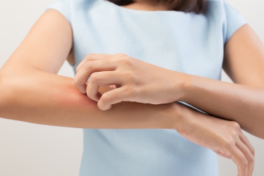 Treatment of Skin Allergy, Fungal Infection, Herpes, Dr Poonam Raut, Best Skin Speciaist in Purnia, Skyn & Laser Clinic, Treatment of Herpes in Purnia