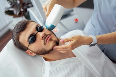 Laser Beard Shaping in Purnia, Best Laser Specialist, Skyn & Laser Clinic, Dr Poonam Raut