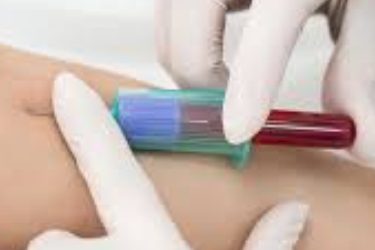 Maurya Collection Centre in Purnia, Blood Test