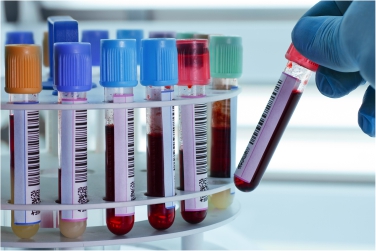 Maurya Collection Centre in Purnia, Blood Test